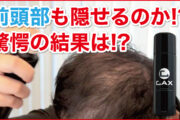 薄くなった前髪の生え際を薄毛隠しスプレーで隠せるか？実際に使ってみた結果！これでM字ハゲでも安心！？