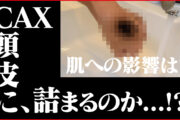 薄毛隠しスプレーは頭皮や肌に悪影響はないの？実際に検証してみた
