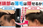 側頭部のスカスカな薄毛...薄毛隠しスプレーで隠せるのか！？