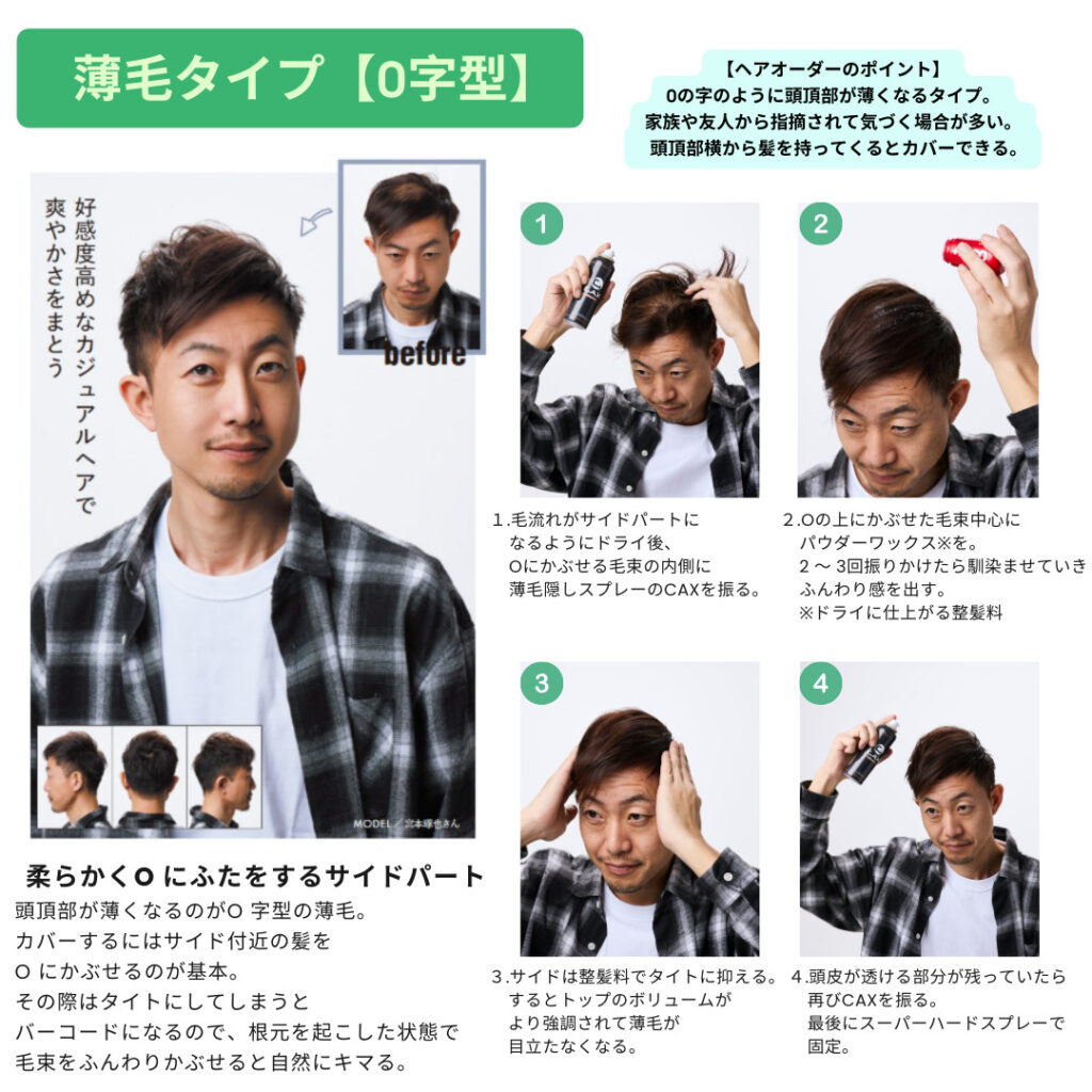 【美容師が教える】ハゲ隠しにオススメな髪型を薄毛タイプ別に徹底解説！│CAXヘアケア情報サイト