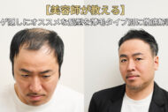 【美容師が教える】ハゲ隠しにオススメな髪型を薄毛タイプ別に徹底解説！