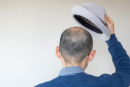 【美容師が教える！】ハゲ隠し対策にオススメの帽子6選！メリット＆注意点とは
